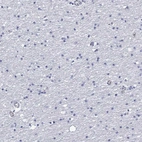 Immunohistochemical staining of human cerebral cortex shows low expression as expected.