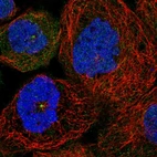 Anti-SDCCAG8 Antibody