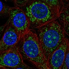 Immunofluorescent staining of human cell line MCF7 shows localization to nucleoli & mitochondria.