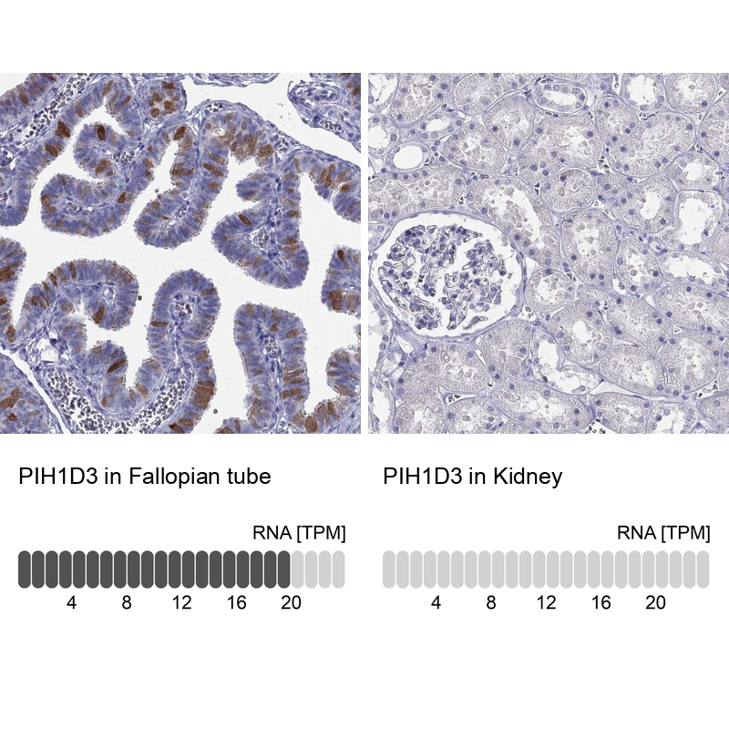 Anti-PIH1D3 Antibody