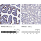 Anti-PIH1D3 Antibody