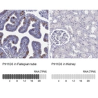 Anti-PIH1D3 Antibody