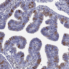 Anti-PIH1D3 Antibody