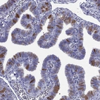 Immunohistochemical staining of human fallopian tube shows moderate cytoplasmic positivity in glandular cells.