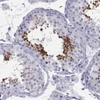 Immunohistochemical staining of human testis shows strong cytoplasmic positivity in cells in seminiferous ducts.
