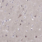 Immunohistochemical staining of human cerebral cortex shows moderate cytoplasmic positivity in neurons.