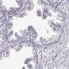 Immunohistochemical staining of human prostate shows no positivity in glandular cells as expected.