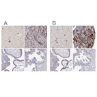 Immunohistochemical staining of human hypothalamus, pituitary gland, placenta and prostate using Anti-VGF antibody HPA072505 (A) shows similar protein distribution across tissues to independent antibody HPA055177 (B).