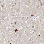 Anti-VGF Antibody