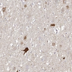 Immunohistochemical staining of human hypothalamus shows strong positivity in a subset of neurons.