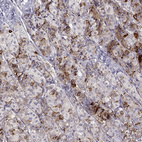 Immunohistochemical staining of human pituitary gland shows strong positivity in anterior cells.