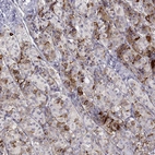 Immunohistochemical staining of human pituitary gland shows strong positivity in anterior cells.