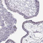 Immunohistochemical staining of human placenta shows no positivity in trophoblastic cells as expected.