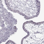 Immunohistochemical staining of human placenta shows no positivity in trophoblastic cells as expected.