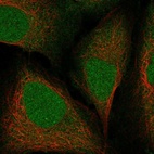 Anti-RIT2 Antibody