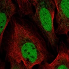 Anti-YEATS4 Antibody