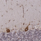 Anti-TMEM14A Antibody