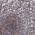 Anti-N4BP2 Antibody