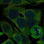 Anti-PLA2G4E Antibody