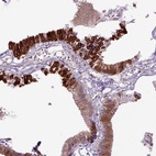 Anti-DEPDC1B Antibody