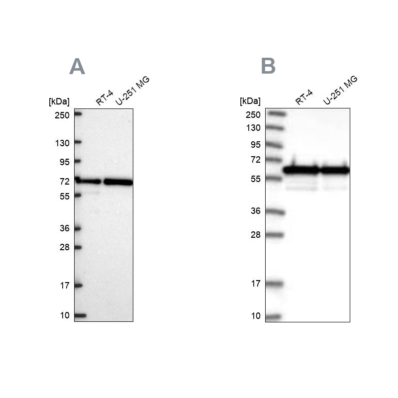Anti-CCDC47 Antibody