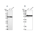 Anti-CCDC47 Antibody