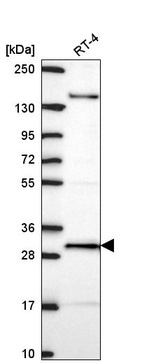 Anti-ORC6 Antibody