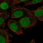 Immunofluorescent staining of human cell line PC-3 shows localization to nucleus & nucleoli fibrillar center.