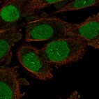 Immunofluorescent staining of human cell line PC-3 shows localization to nucleus & nucleoli fibrillar center.