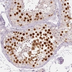 Immunohistochemical staining of human testis shows moderate to strong nuclear positivity in a subset of cells in seminiferous ducts.