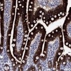 Anti-FRK Antibody