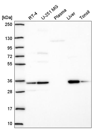 Anti-TMEM183A Antibody