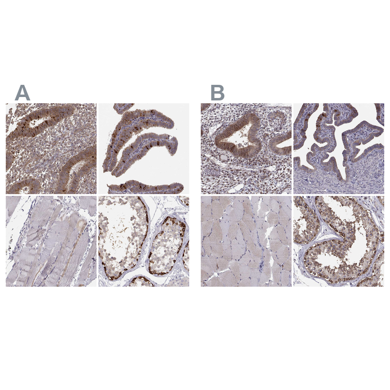 Anti-HSP90AB1 Antibody