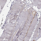 Immunohistochemical staining of human skeletal muscle shows weak cytoplasmic positivity in myocytes.