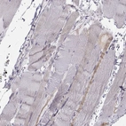Immunohistochemical staining of human skeletal muscle shows weak cytoplasmic positivity in myocytes.