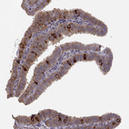 Immunohistochemical staining of human fallopian tube shows strong cytoplasmic/membranous positivity in glandular cells.