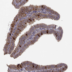 Anti-HSP90AB1 Antibody