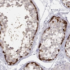 Immunohistochemical staining of human testis shows strong membranous/cytoplasmic positivity in spermatogonia.