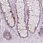 Immunohistochemical staining of human rectum shows moderate to strong nuclear positivity in a subset of glandular cells.