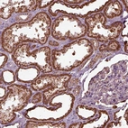 Anti-TMEM254 Antibody