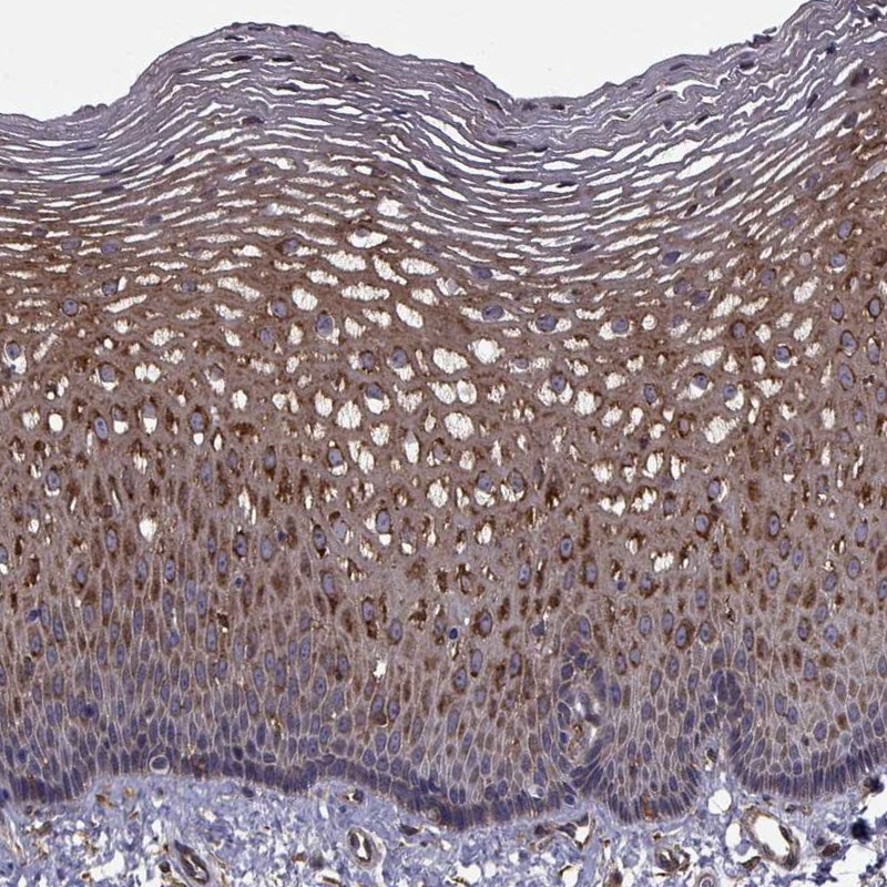 Anti-TRIP10 Antibody