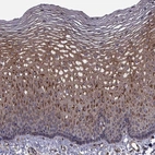 Anti-TRIP10 Antibody