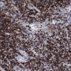 Immunohistochemical staining of human tonsil shows strong membranous positivity in non-germinal center cells.