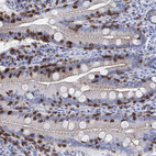 Immunohistochemical staining of human small intestinal shows strong membranous positivity in lymphoid cells and glandular cells,