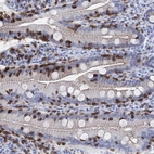 Immunohistochemical staining of human small intestinal shows strong membranous positivity in lymphoid cells and glandular cells,