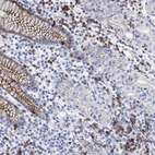Immunohistochemical staining of human stomach shows strong membranous positivity in glandular cells and lymphoid cells