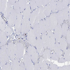 Immunohistochemical staining of human skeletal muscle shows negative positivity in myocytes.