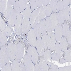 Immunohistochemical staining of human skeletal muscle shows negative positivity in myocytes.