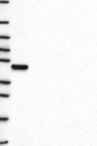 Lane 1: Marker [kDa] 250, 130, 95, 72, 55, 36, 28, 17, 10 | Lane 2: RT4 | Lane 3: U-251 MG | Lane 4: Human Plasma | Lane 5: Liver | Lane 6: Tonsil