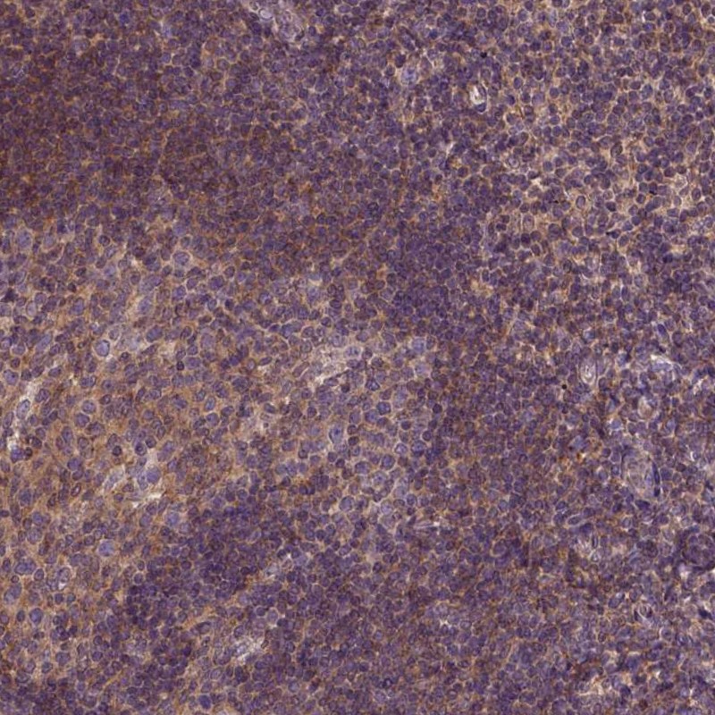 Anti-CPNE1 Antibody